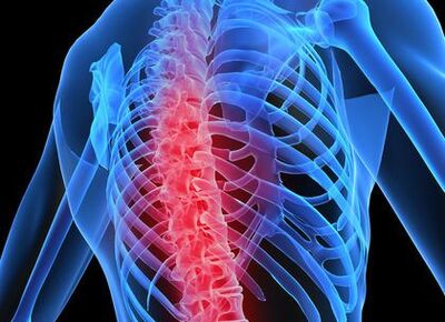 Таза омурткасынын остеофондрозу